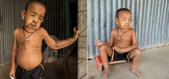 Tiene 4 Años y Aparenta 80 Tiene 4 Años y Aparenta 80