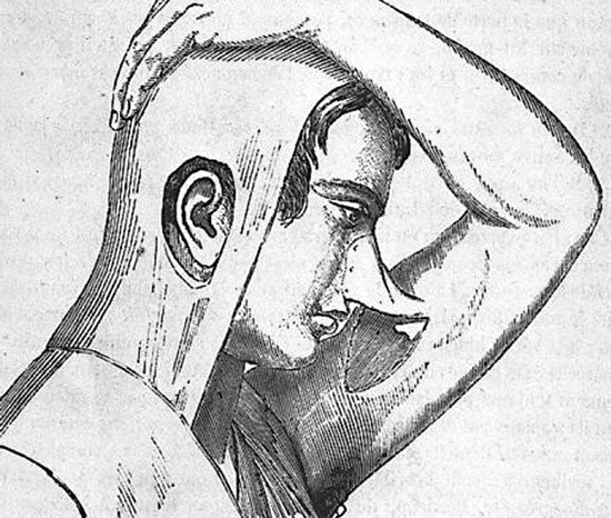 operaciones de estética historia